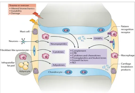 Figure 30 : L’inflammation de bas grade engendrée par le SII dans la pathogénèse de l’arthrose 