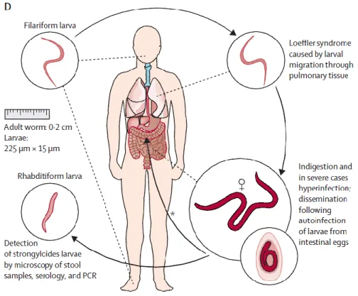 Figure 9 : Cycle parasitaire de Strongyloides stercoralis 