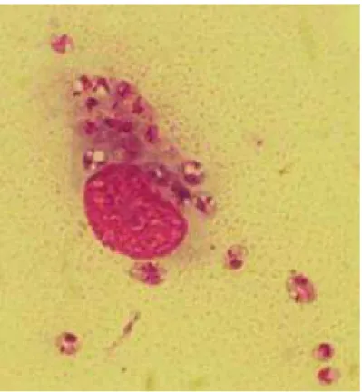Figure 2: Leishmania infantum sous forme amastigote (7). 