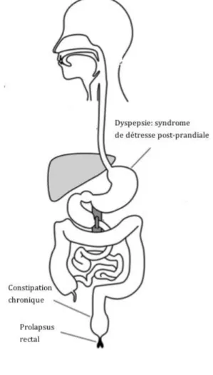 Figure 4: Désordres gastro-intestinaux dus à l'anorexie (48) 