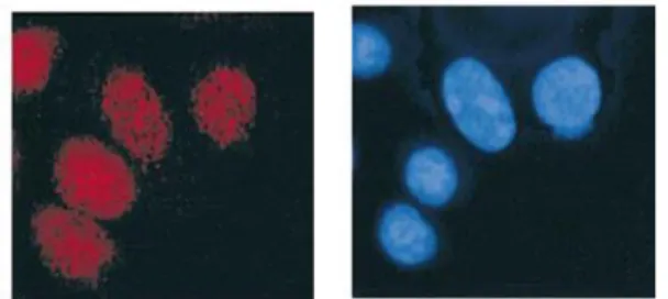Figure 4 : Localisation nucléaire de l’ubinucléine  visualisée en microscopie à fluorescence  (Aho et  al., 2000) en rouge le marquage immunofluorescent  de l’Ubn, en bleu les noyaux marqués au DAPI dans  des kératinocytes de prépuce en culture 