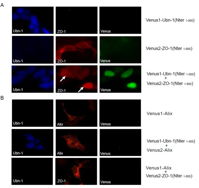 Figure  6 :  Interaction  in  vivo  entre  les  parties  N-terminales  de  l’ubinucléine  et  de  ZO-1  visualisée par une technique de complémentation de fluorescence