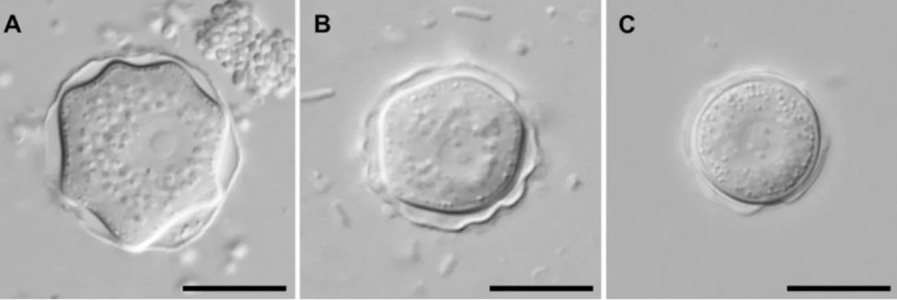 Figure 5: Formes variables d’endokystes d’Acanthamoeba par microscopie à contraste  d’interférence