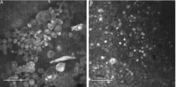 Figure 9:Images évocatrices de kystes amibiens en microscopie confocale in vivo (HRTII-RCM)  [70] 