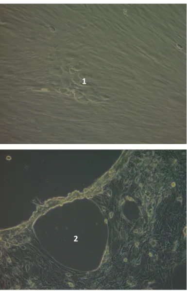 Figure 3- Visualisation d’ECP sur cellules MRC5 inoculées avec de l’HAdV type 2,  