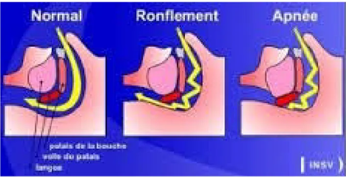 Figure 4 : Flux respiratoires (28)