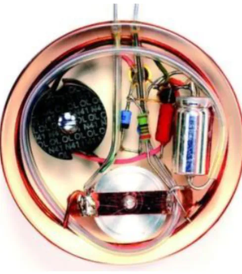 Figure 11 :   Le premier pacemaker implanté en 1958 SIEMENS ELEMA 