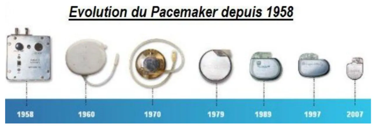 Figure 12 :   Evolution des stimulateurs cardiaques 