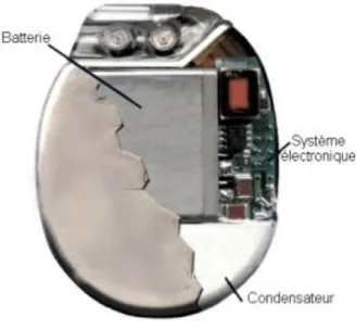 Figure 15 :   Défibrillateur automatique implantable 