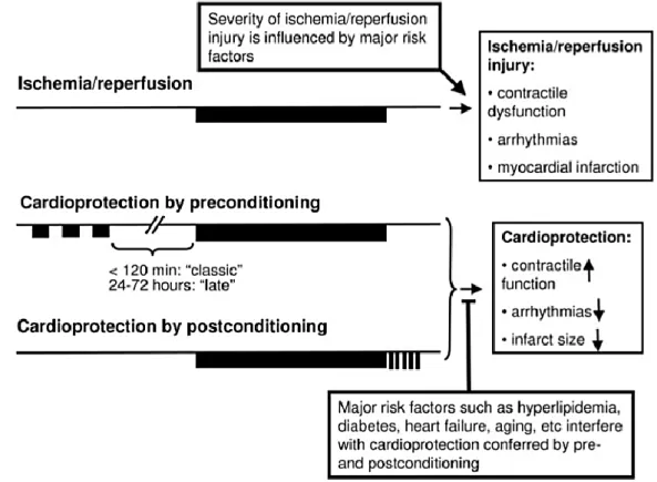 Figure 11 : Pré-conditionnement et post-conditionnement. Illustration par Ferdinandy et al [87]