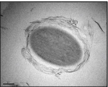 Figure 1.7. Les protozoaires peuvent enrober des billes de polystyrène  dans  des  corps  multilamellaires