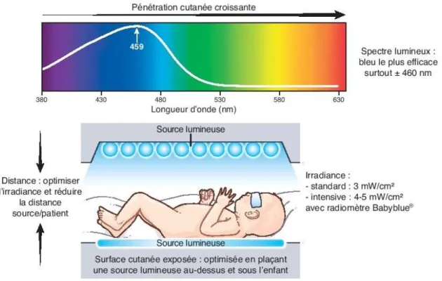 Figure 14 : Facteurs influençant l'efficacité de la photothérapie de l’ictère néonatal 
