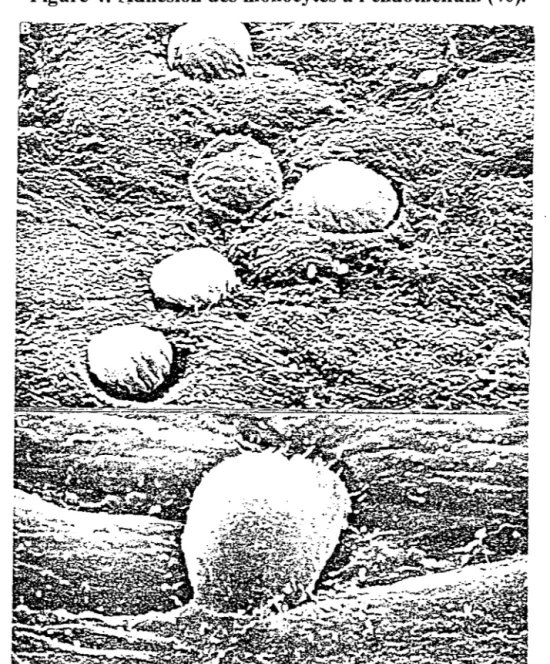 Figure 4:  Adhésion des monocytes à l'endothélium (46). 