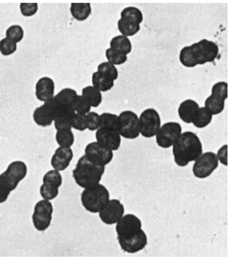 Figure 1. Vue au microscope électronique à transmission (X 6500) de streptocoques du  groupe A groupés en chaînettes