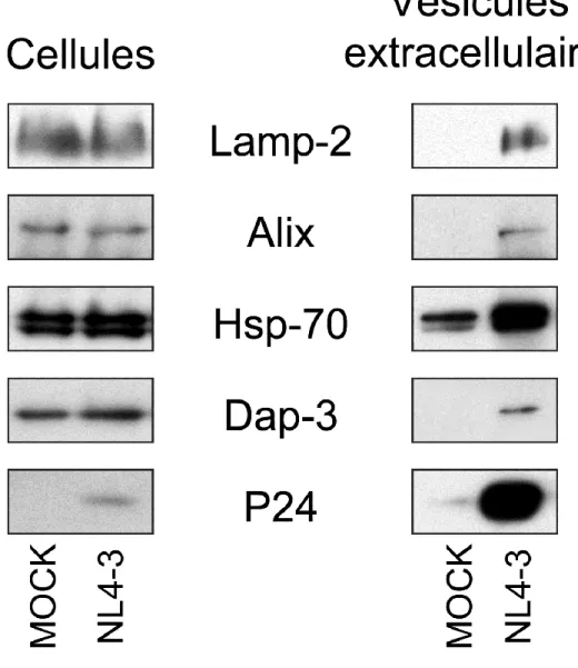 Figure 6 : Caractérisation des vésicules extracellulaires issues des cellules RAJI CD4  DCIR infectées au VIH-1