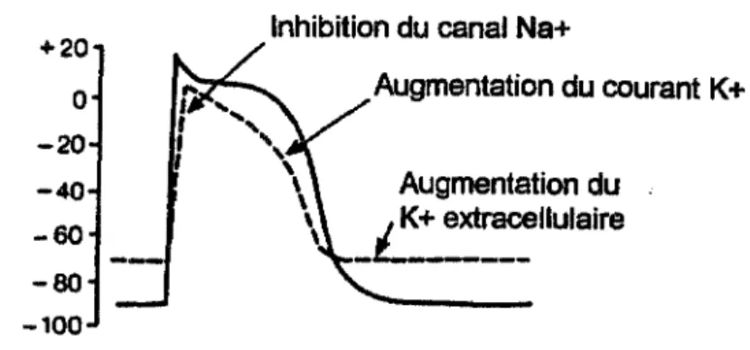 Figure 4:  &#34;Modification du potentiel d'action lors d'une ischémie&#34;. (d'après Opie,  1991)