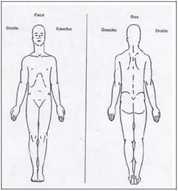 Figure 2 : Schéma corporel des zones douloureuses (22) 