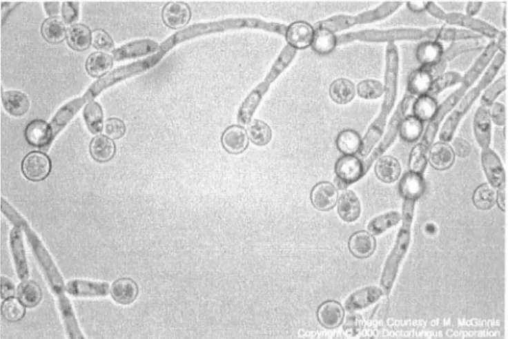 Figure 4.  Production de chlamydospores parC.  albicans d'après  (http://www.doctorfungus.org)