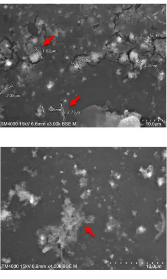 Figure 6: Examen au microscope électronique à balayage en temps réel de différents pus  d’abcès cérébral de patient à l’aide d’un microscope TM4000 (Hitachi)