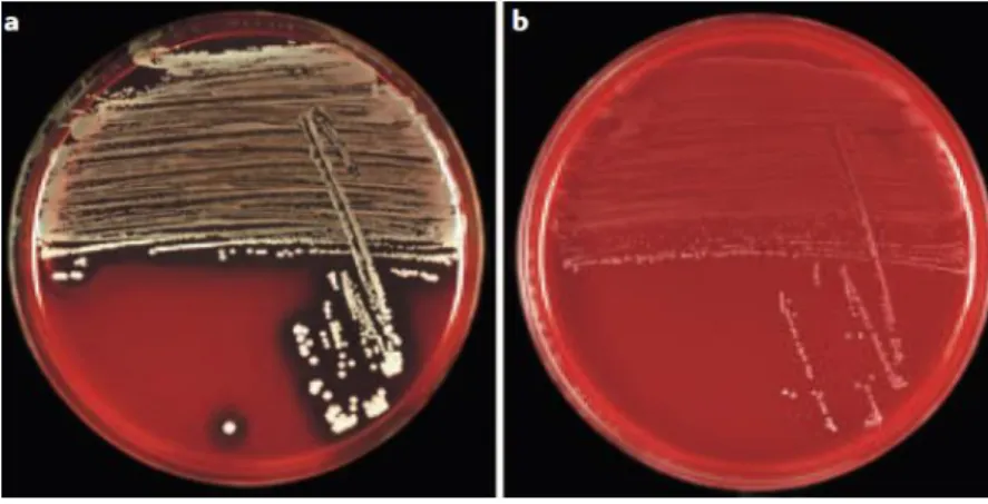 Figure 8 : Gélose sang avec des colonies de Staphylococcus aureus normales à gauche et des SCVs à droite  (64)