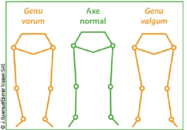 Figure 7. Orientation de l’axe des membres inférieurs (13) 