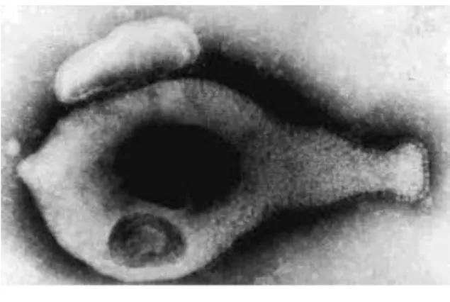 Figure 2: Observation au microscope  électronique de M. genitalium 