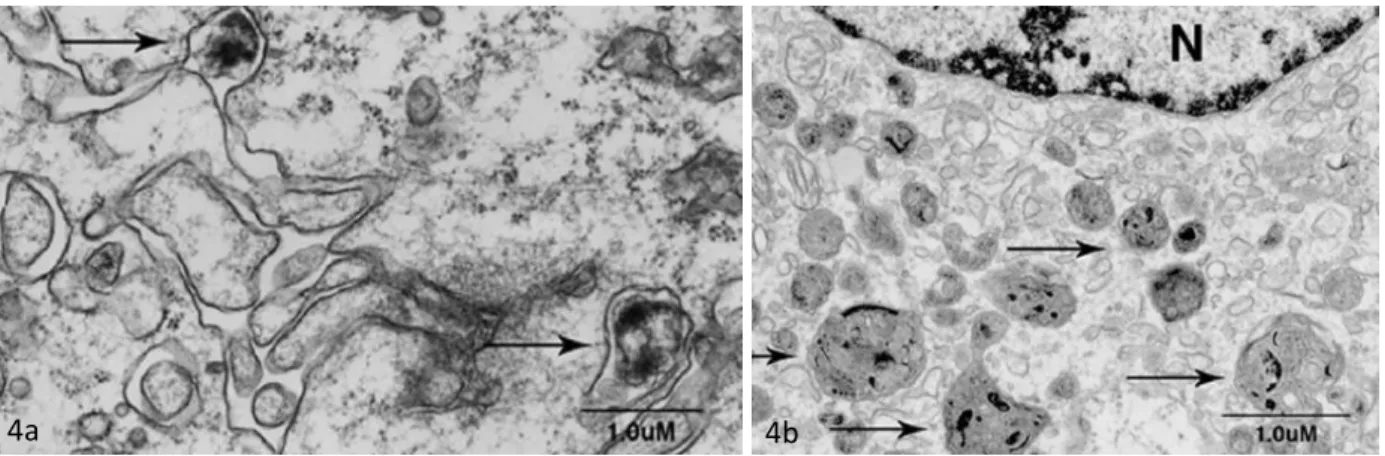 Figure  4:  4a  Observation  au  microscope  électronique  du  changement  morphologique  de  M  genitalium [23] 