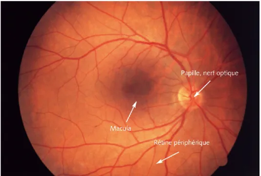 Figure 4 : Fond d’œil normal (œil droit). 