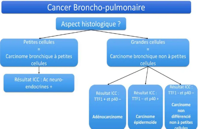 Figure 11 : Arbre décisionnel du diagnostic des carcinomes bronchiques 