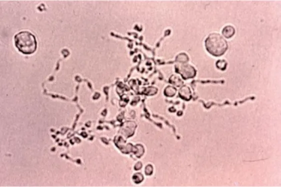 Figure 8 : Mégacaryocyte en fin de maturation.  La cellule se retrouve déformée, projetant de longs pseudopodes  tentaculaires, les pro-plaquettes (6)