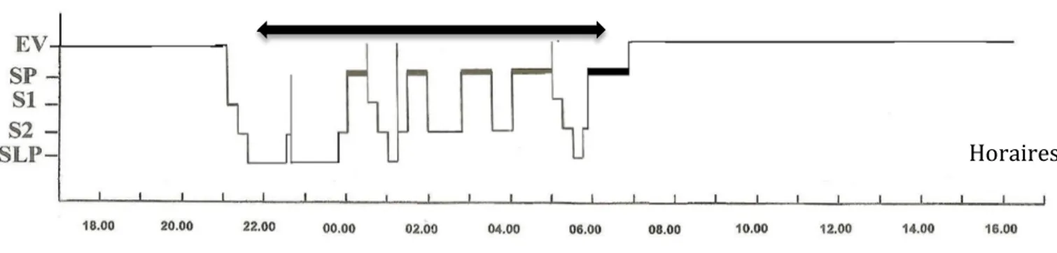 Figure 12: Hypnogramme d’un enfant de 6 à 11 ans (39) 