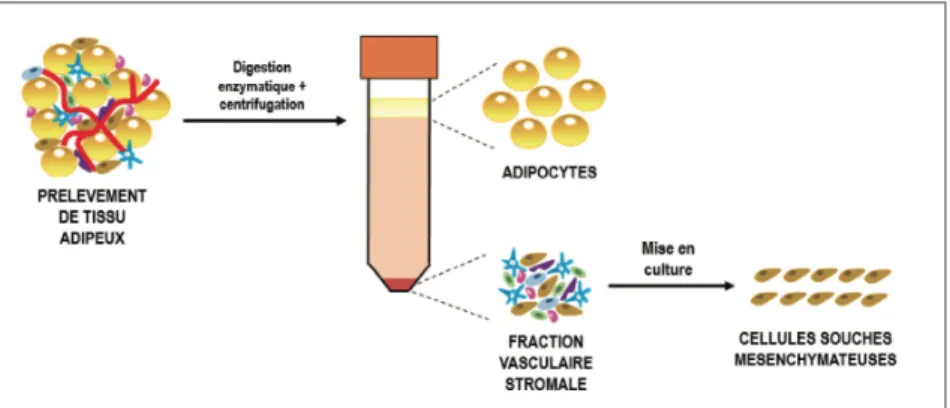 Figure 11 : Obtention de la FVS et des CSM à partir d’un prélèvement de tissu adipeux (21)  Au-delà de la médecine régénérative, les capacités des CSM à moduler la mort cellulaire, la  réponse immune et la cicatrisation ont permis de développer des thérap