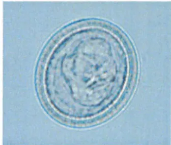 Figure 4 : Embryophore de Trenidés  (Laboratoire de Parasitologie, Strasbourg) 