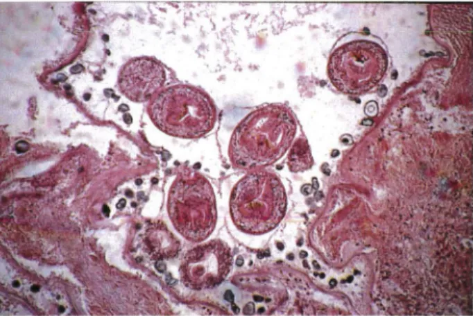 Figure 6 : Aspect microscopique de l'échinococcose alvéolaire dans le foie d'un  rongeur réceptif  (Laboratoire de Parasitologie, Strasbourg) 