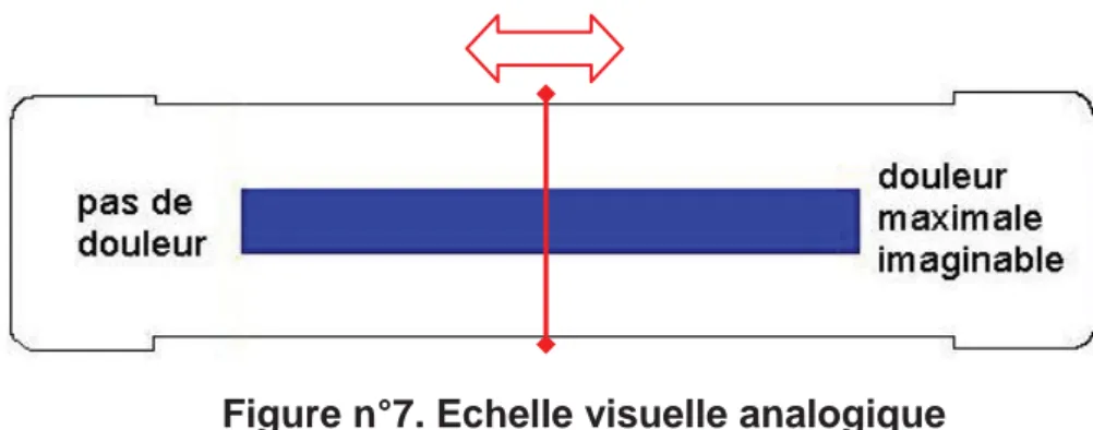 Figure n°7. Echelle visuelle analogique 