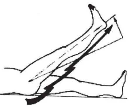 Figure n°8. Mesure du signe de Lasègue 