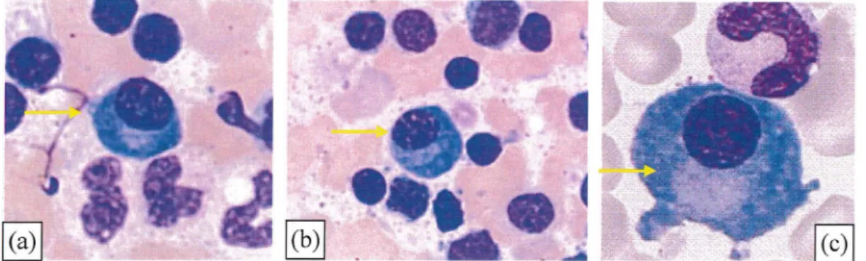 Figure  23  :  Aspect cytologique de plasmocytes 