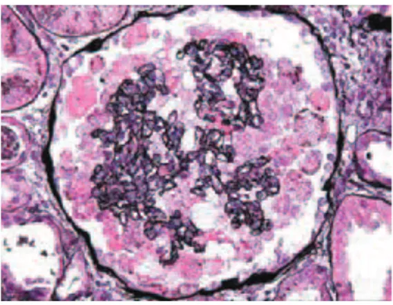 Figure 9 HSF Tip © D’agati 