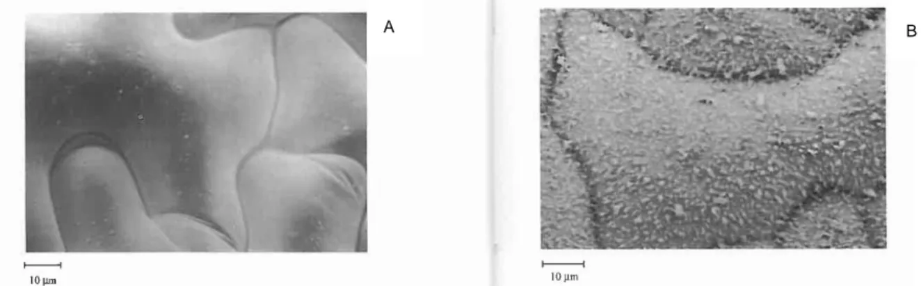 Figure  28:  Observation  au  microscope  électronique  à  balayage  sur  les  faces  foliaires  adaxiales du gaillet (A) et du colza (B) Source: (Gauvrit, 1996) 
