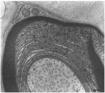 Figure 1 : Présence de plusieurs lamelles de myéline non compactées à la partie interne de la gaine de myéline