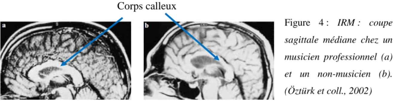 Figure  4 :  IRM :  coupe  sagittale  médiane  chez  un  musicien  professionnel  (a)  et  un  non-musicien  (b)