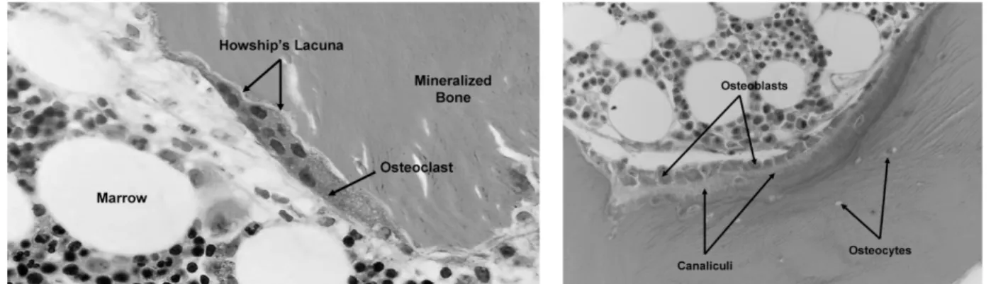 Figure 2:  Bone tissue remodeling. Osteoclasts resorb bone to form resorption pits  known as Howship's lacunae (left)