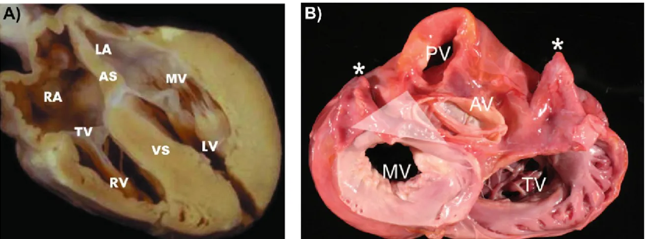 Figure 2-1. Gross anatomy of a normal heart. A) Four chamber view of the heart. The atria  septum (AS) separates the left (LA) and right (RA) atria
