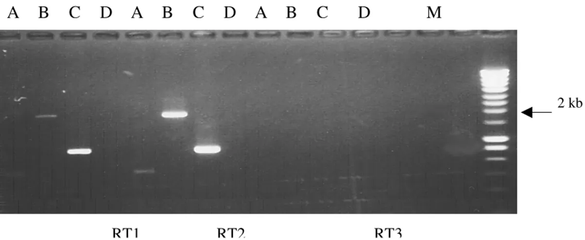 Fig 22 : Analyse sur gel d'agarose 1% du cDNA de BoMX1. Les réactions de RT-PCR réalisées pour  l'amplification de BoMX1 à partir de PBMC stimulés au poly I:C (RT1), de cellules MDBK stimulées à  l'interféron  α  (RT2)  et  de  cellules  Vero  non  stimulé