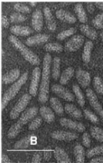 Figure 1: particules virales de CBPV (Olivier et Ribière, 2006). 