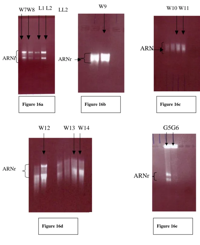 Figure 16 : Visualisation sur gel d’agarose des  ARN totaux. La concentration en agarose est de 1,2% pour les  figures a, b, c et e et de 1,5% pour la figure d