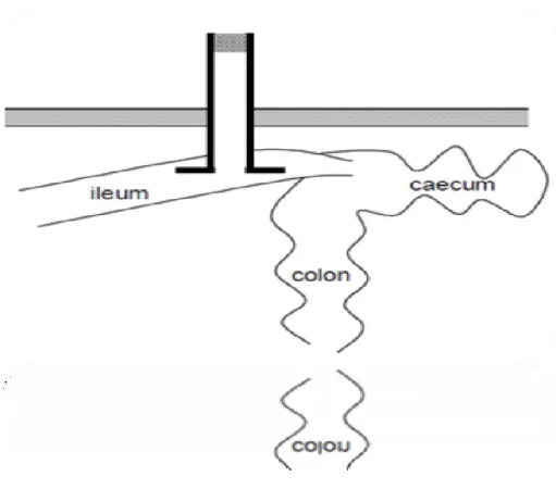 Figure 1-1 Technique de canulation simple avec une canule en T (tiré de Sauer et al.,  1983) 