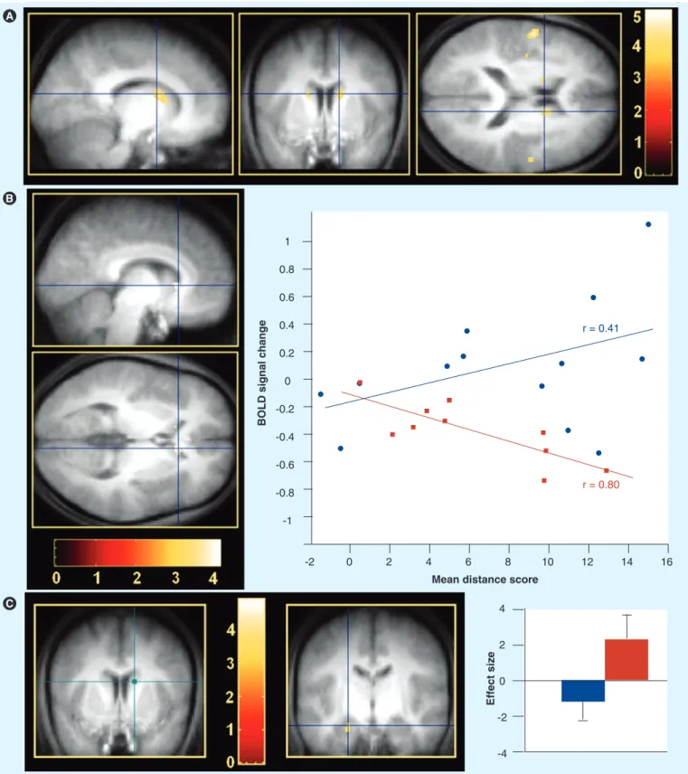 Figure 4. Sleep-dependent modulation of brain activity. Contrasts are displayed at p &lt; 0.001 (uncorrected) superimposed on the  average T1-weighted MRI scan