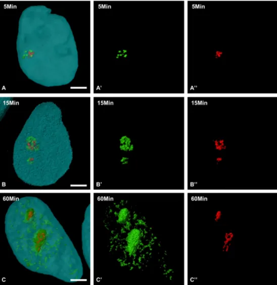 Fig. 6. Three-dimensional structure of nucleolar subdomains containing the BrUTP-labelled RNAs during the movement within the nucleolus