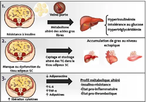 Figure  4.  Mécanismes  reliant  l’accumulation  de  gras  au  niveau  viscéral  et  les  complications  métaboliques